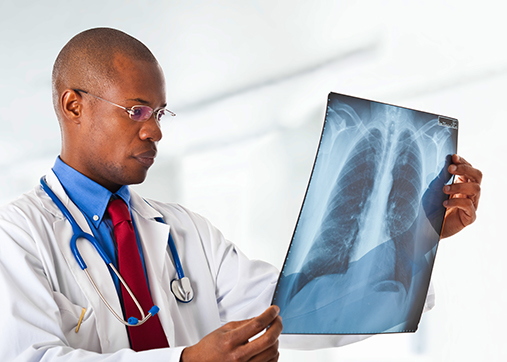 pulmonologist reviewing chest x-ray
